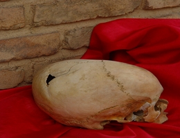 Medical Anthropology